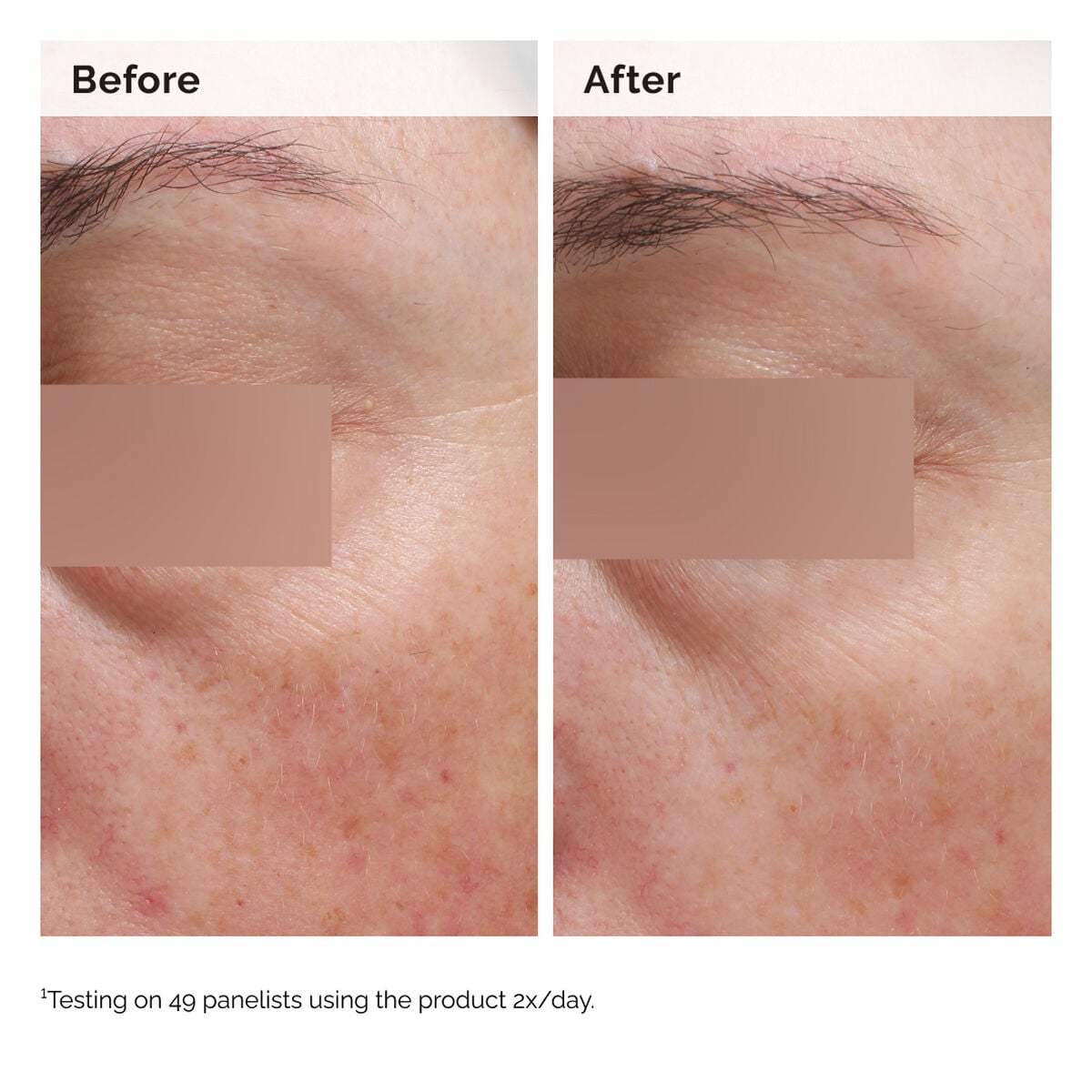 niacinamide-5-face-and-body-emulsion-f3 2024-08-23-ORD-Nia-5pct-Face-Body-B-A-Elasticity-Global-02-1x1.jpg