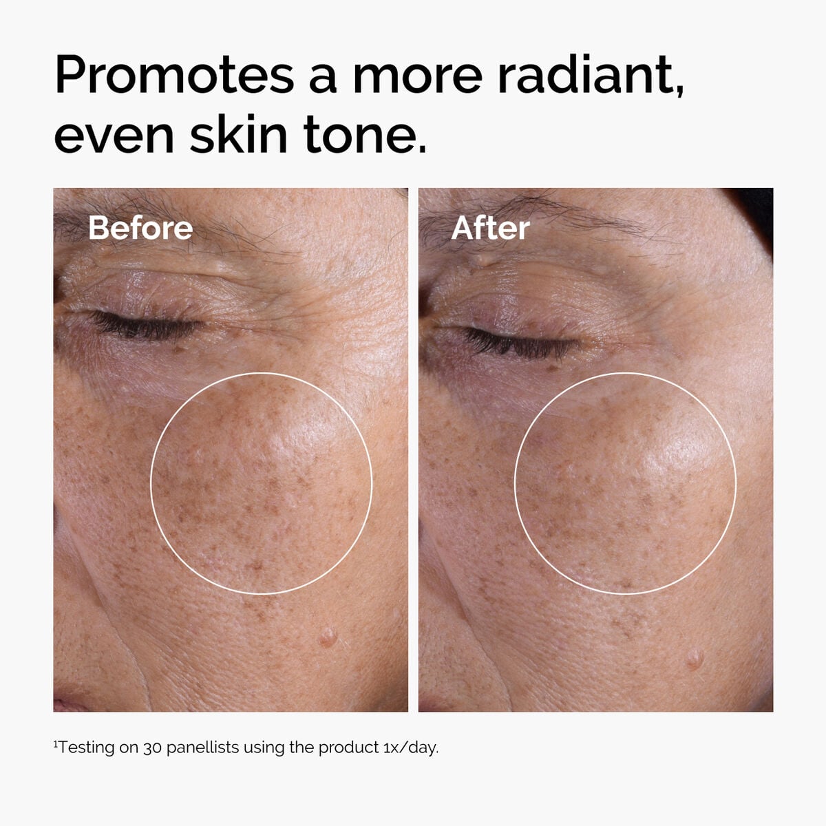 glycolic-acid-7-exfoliating-toner-r3 ord-glycolic-before-after-radiance.jpg