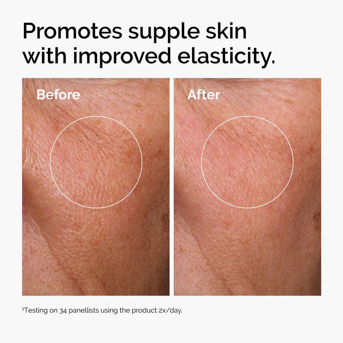 hyaluronic-acid-2-b5-with-ceramides-k6 ord-hyaluronic-acid-2pct-b5-hydrating-serum-before-after-elasticity.jpg
