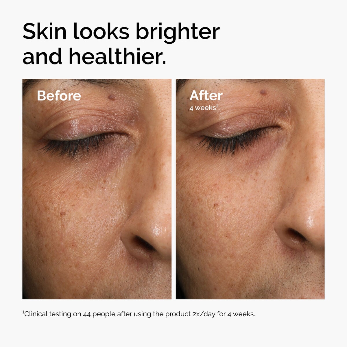 multi-antioxidant-radiance-serum-k4 ord-mars-before-after-healthy.jpg