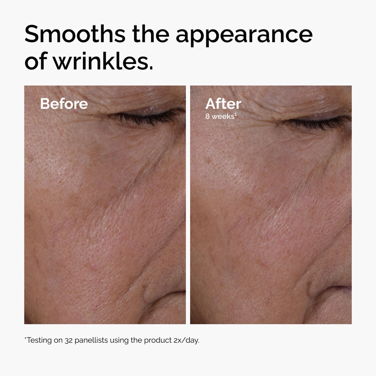 multi-peptide-ha-serum-t5 ord-multi-peptide-ha-serum-wrinkles-before-after.jpg