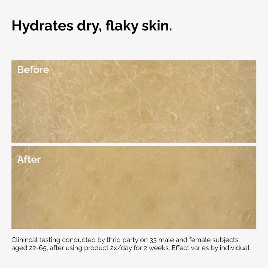 the-body-care-collection-m9 ord-natural-moisturizing-factors-inulin-body-before-after-graphic-02.jpg
