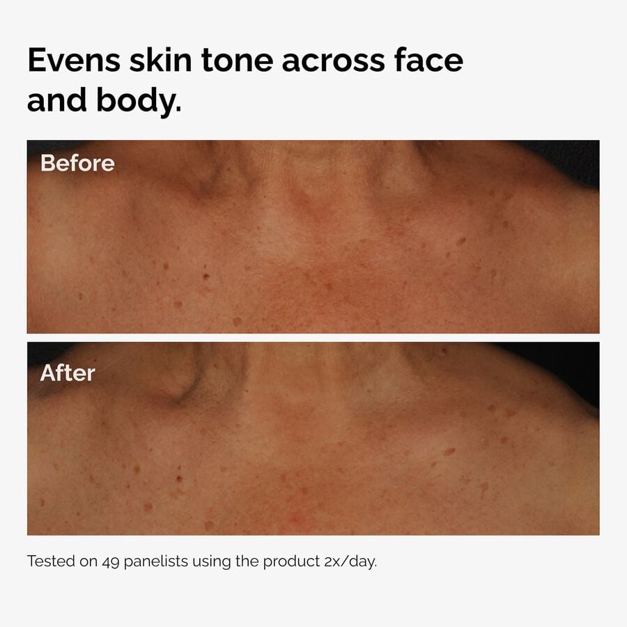 the-body-care-collection-m9 ord-niacinamide-face-body-serum-before-after-even-tone-graphic.jpg
